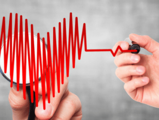 Should we screen people for irregular heartbeat?