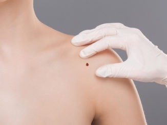 Moving skin cancer treatment to GPs may be costly