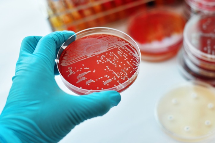 Colonies of bacteria in petri dish (blood agar)