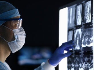 NEWS: AI Screening Tools Set for NHS-Wide Trials to Detect Cancer Earlier Male doctor in surgical clothes looking at vertebral mri scan headshot