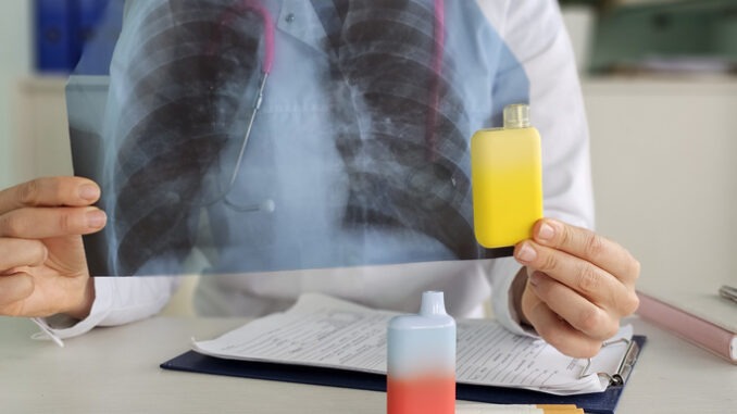 Doctor holds vape and X-ray lungs. Consequences of smoking vape electronic cigarettes. Harm of electronic cigarettes and influence of electronic cigarettes on human body