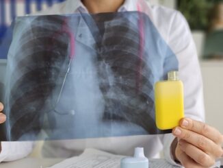 Doctor holds vape and X-ray lungs. Consequences of smoking vape electronic cigarettes. Harm of electronic cigarettes and influence of electronic cigarettes on human body