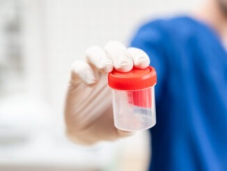 doctor in blue uniform and latex gloves is holding an empty plastic container for taking urine samples, light background