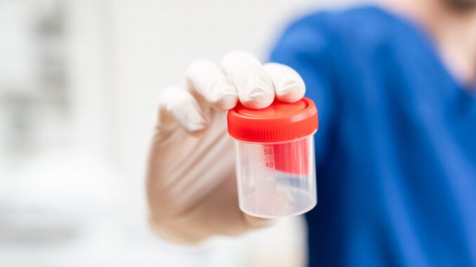 doctor in blue uniform and latex gloves is holding an empty plastic container for taking urine samples, light background